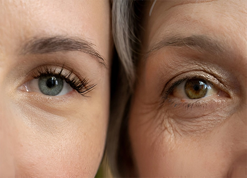 Biological Age